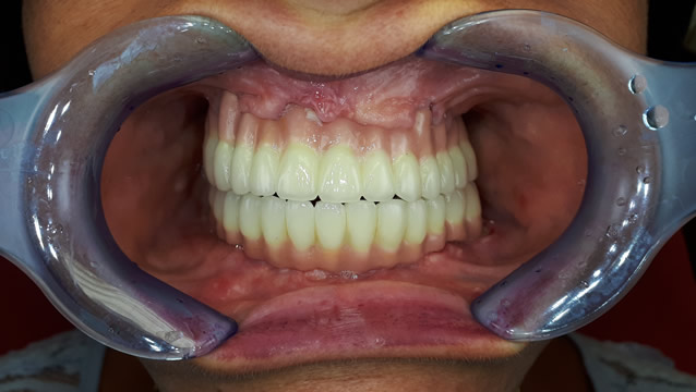 Dental Services in Hungary - Gallery