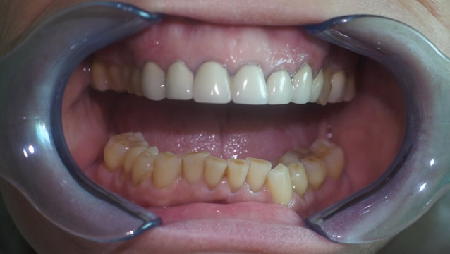 Dental Services in Hungary - Gallery